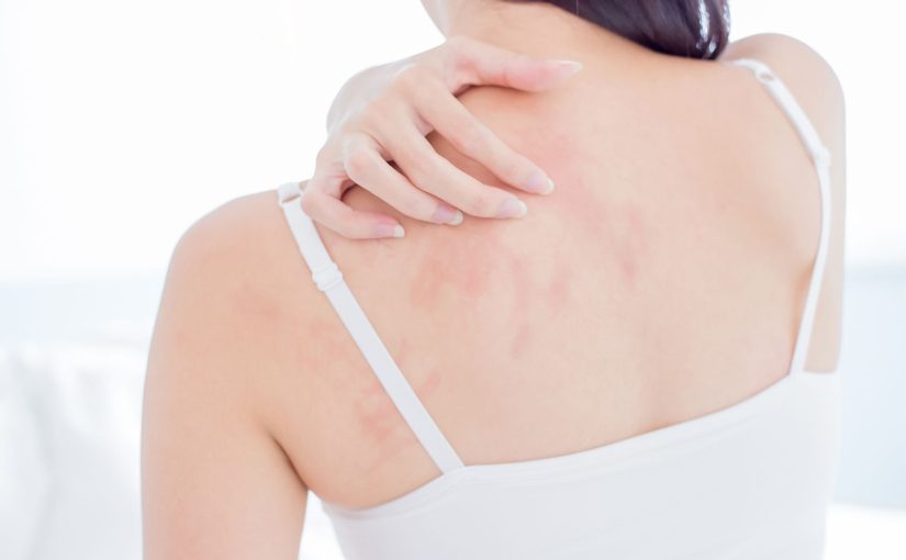 Can a Humidifier Help With Eczema